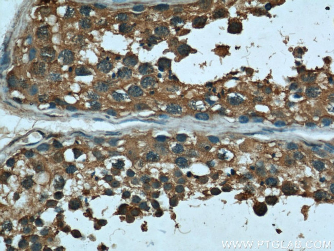 Bcl-XL Antibody in Immunohistochemistry (Paraffin) (IHC (P))