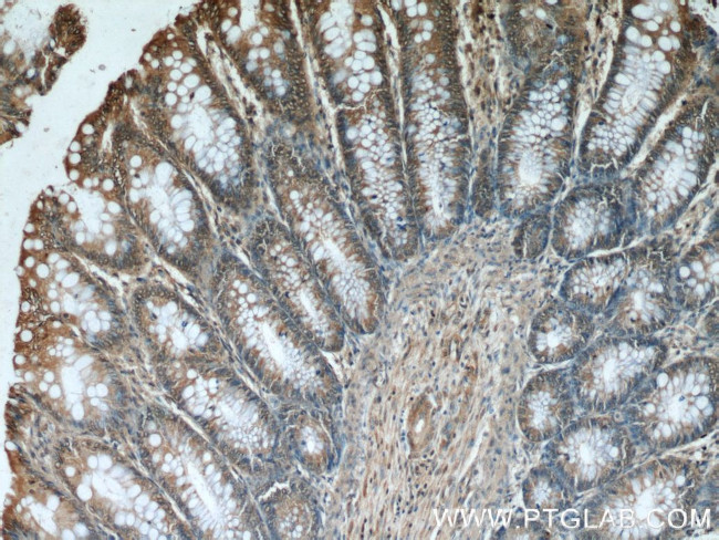 Bcl-XL Antibody in Immunohistochemistry (Paraffin) (IHC (P))