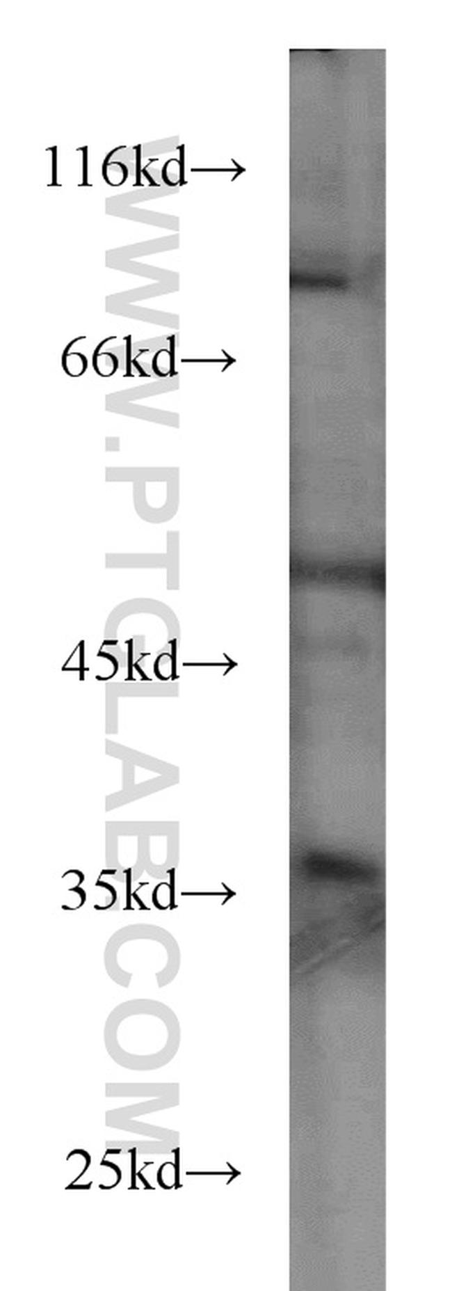 Bcl-XL Antibody in Western Blot (WB)