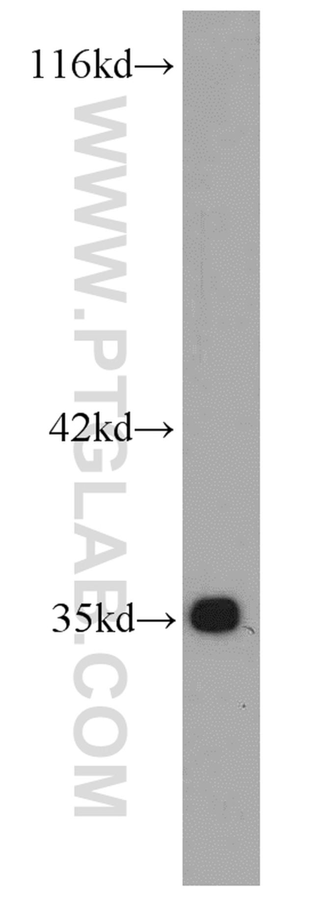 Bcl-XL Antibody in Western Blot (WB)