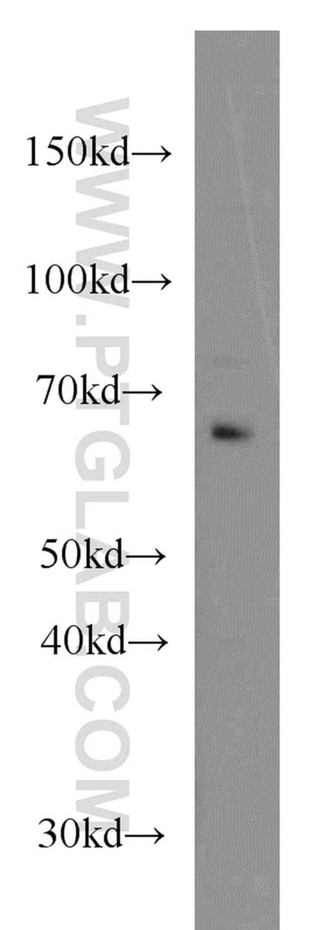 CDC6 Antibody in Western Blot (WB)