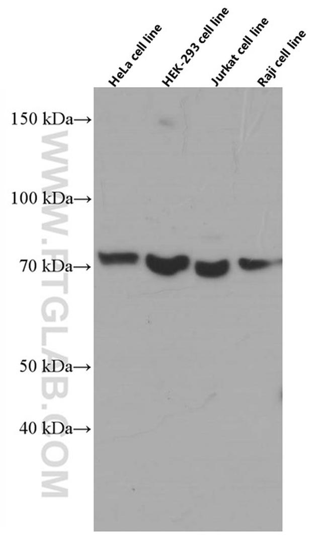 CDC6 Antibody in Western Blot (WB)