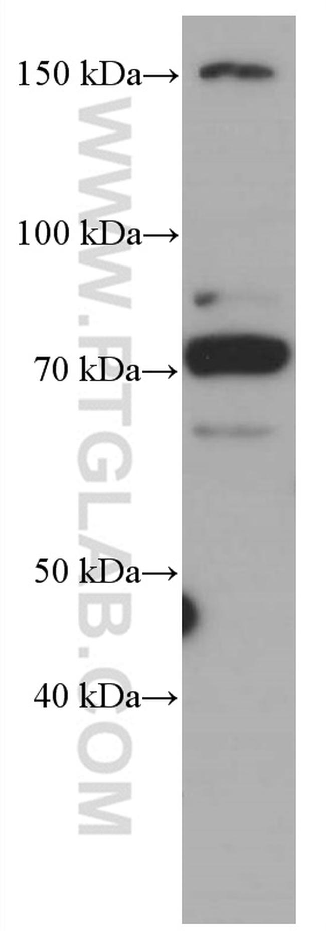 CDC6 Antibody in Western Blot (WB)