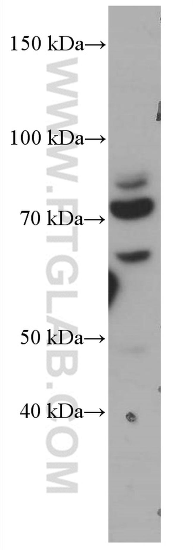 CDC6 Antibody in Western Blot (WB)