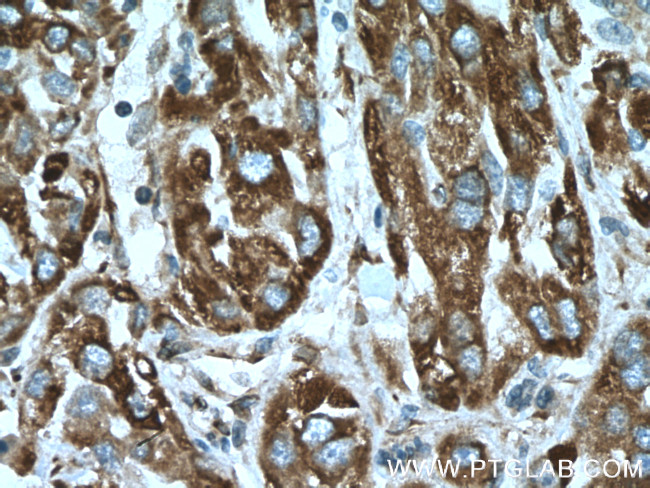 CYB5R3 Antibody in Immunohistochemistry (Paraffin) (IHC (P))