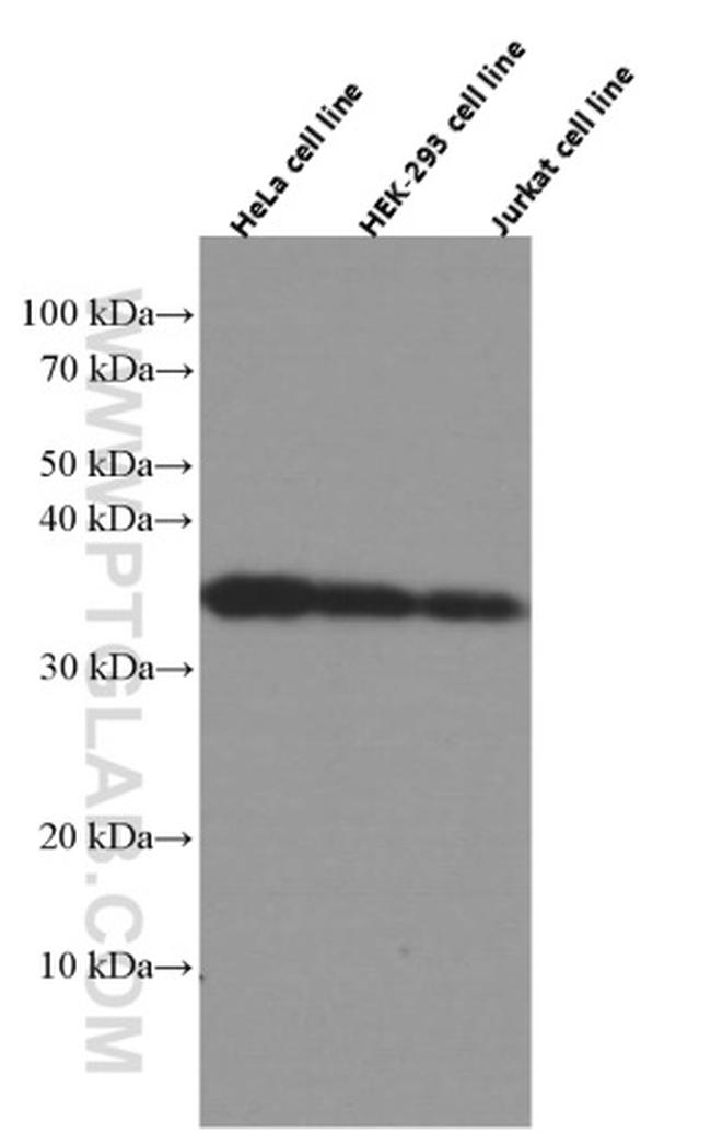 CYB5R3 Antibody in Western Blot (WB)