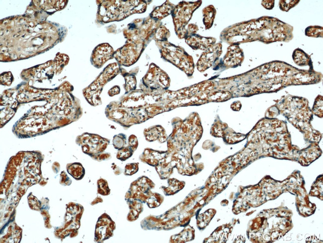 CYB5R3 Antibody in Immunohistochemistry (Paraffin) (IHC (P))