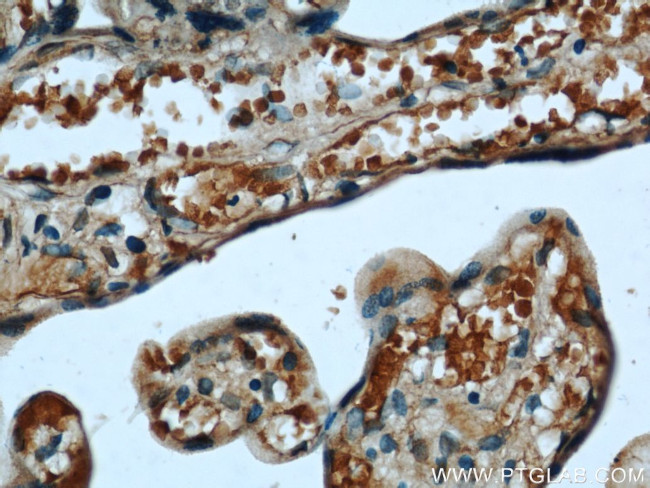 CYB5R3 Antibody in Immunohistochemistry (Paraffin) (IHC (P))