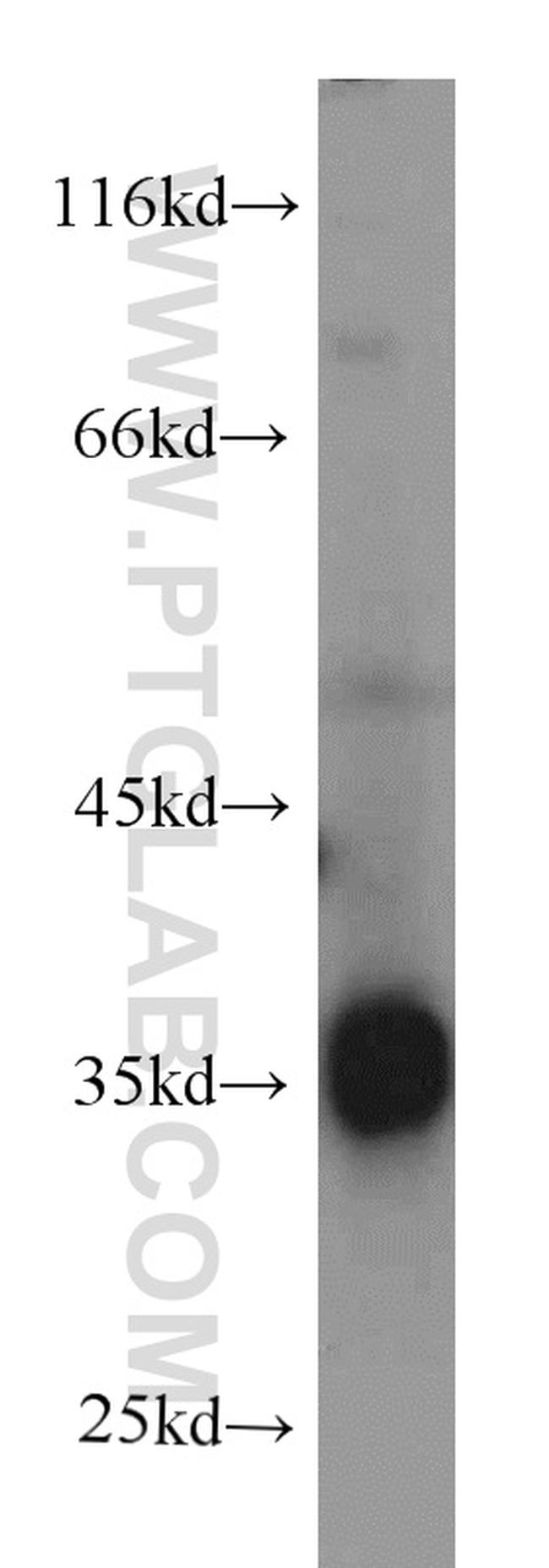 CYB5R3 Antibody in Western Blot (WB)