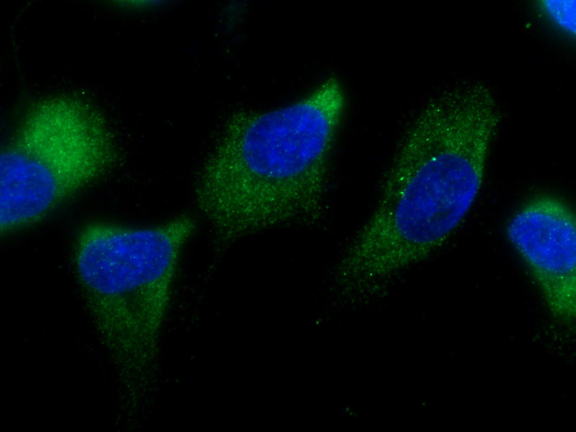 EIF3M Antibody in Immunocytochemistry (ICC/IF)