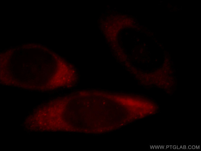 EIF3M Antibody in Immunocytochemistry (ICC/IF)