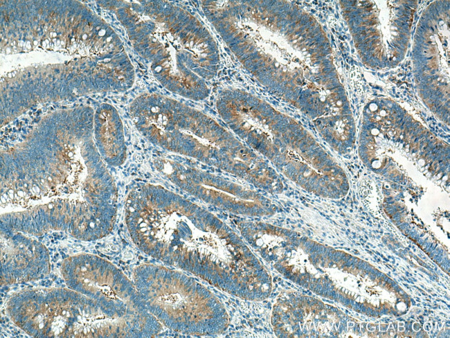 EIF3M Antibody in Immunohistochemistry (Paraffin) (IHC (P))