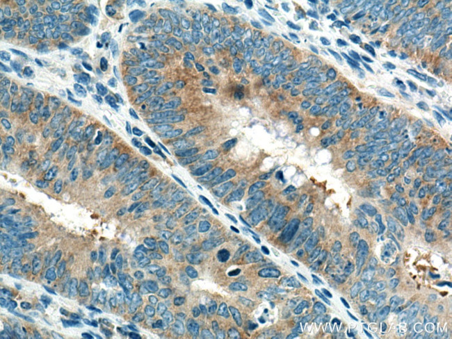 EIF3M Antibody in Immunohistochemistry (Paraffin) (IHC (P))