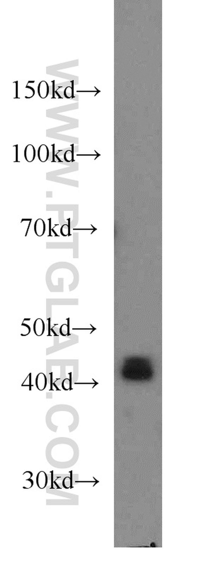 EIF3M Antibody in Western Blot (WB)