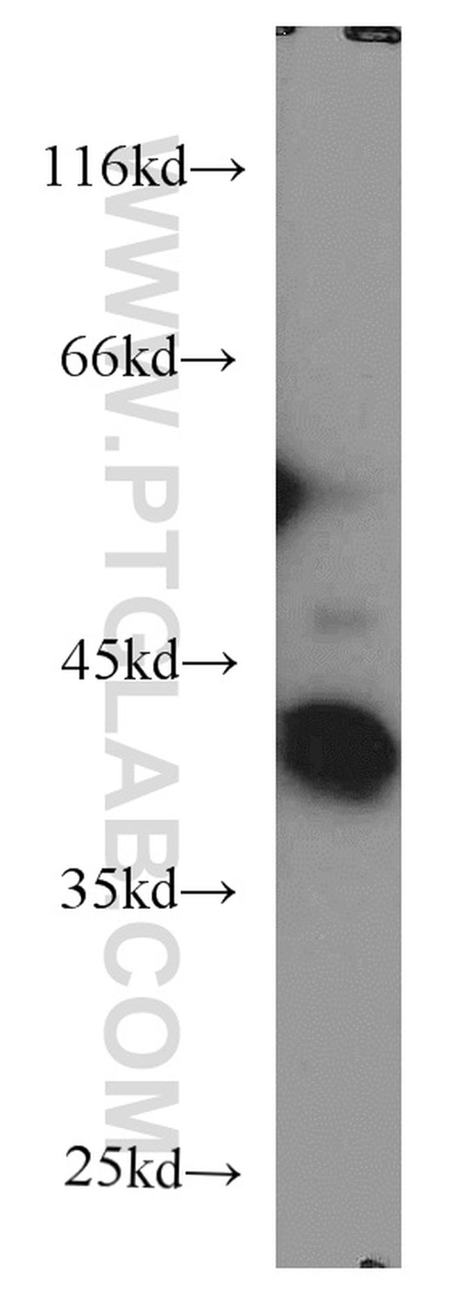 EIF3M Antibody in Western Blot (WB)