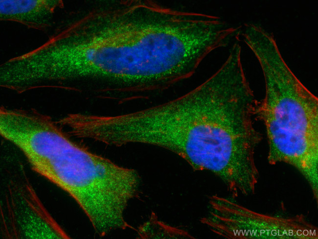 MCL1 Antibody in Immunocytochemistry (ICC/IF)