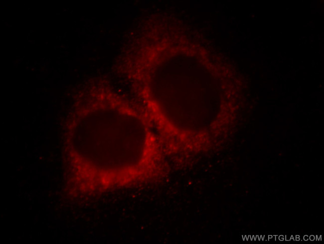 MCL1 Antibody in Immunocytochemistry (ICC/IF)