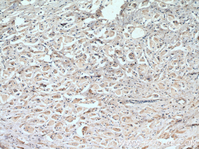 MCL1 Antibody in Immunohistochemistry (Paraffin) (IHC (P))