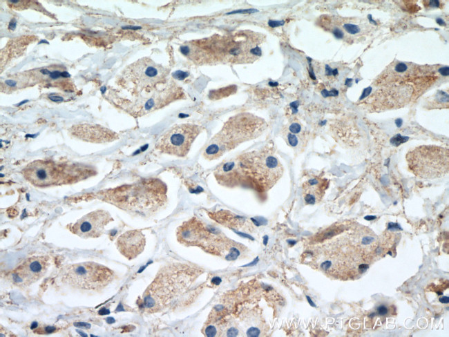 MCL1 Antibody in Immunohistochemistry (Paraffin) (IHC (P))