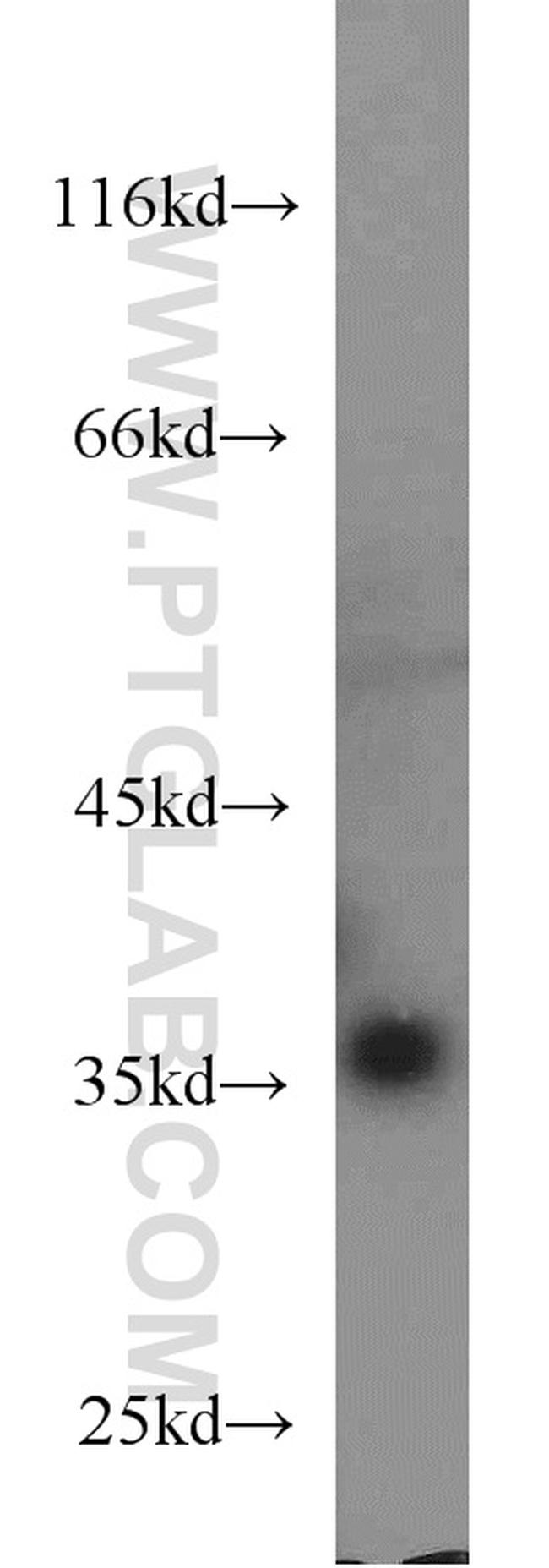 MCL1 Antibody in Western Blot (WB)