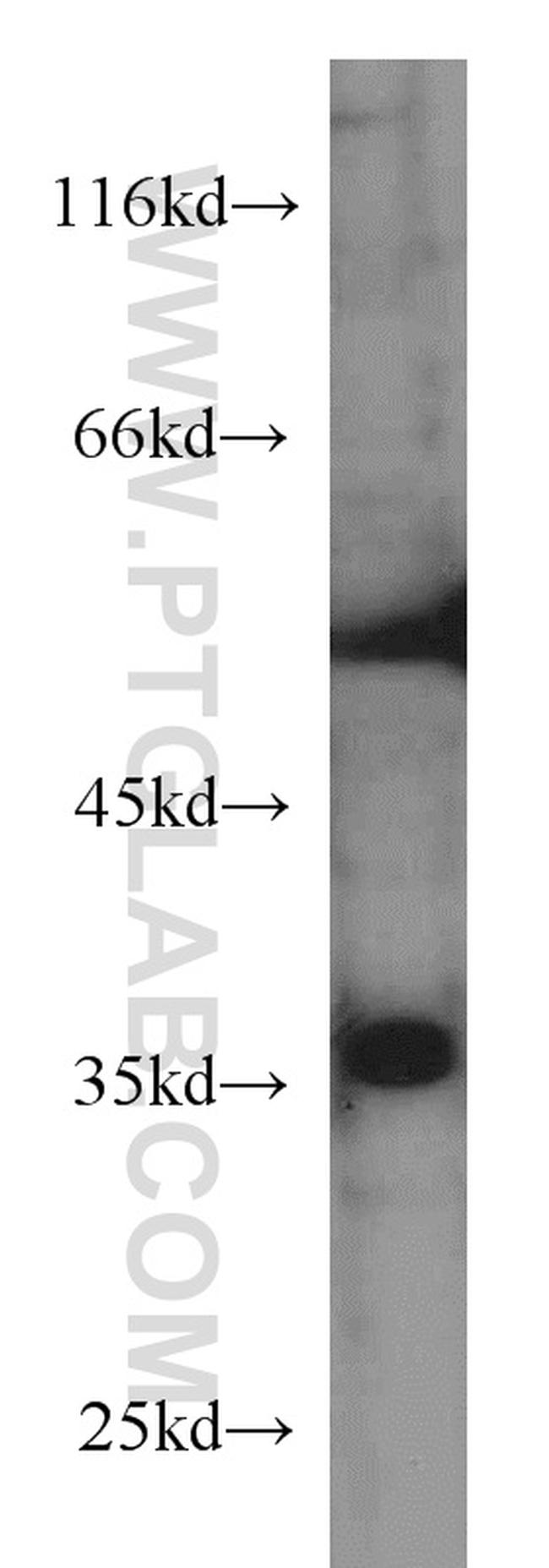 MCL1 Antibody in Western Blot (WB)