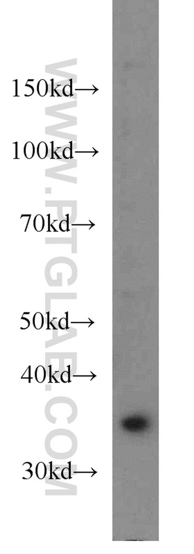 MCL1 Antibody in Western Blot (WB)