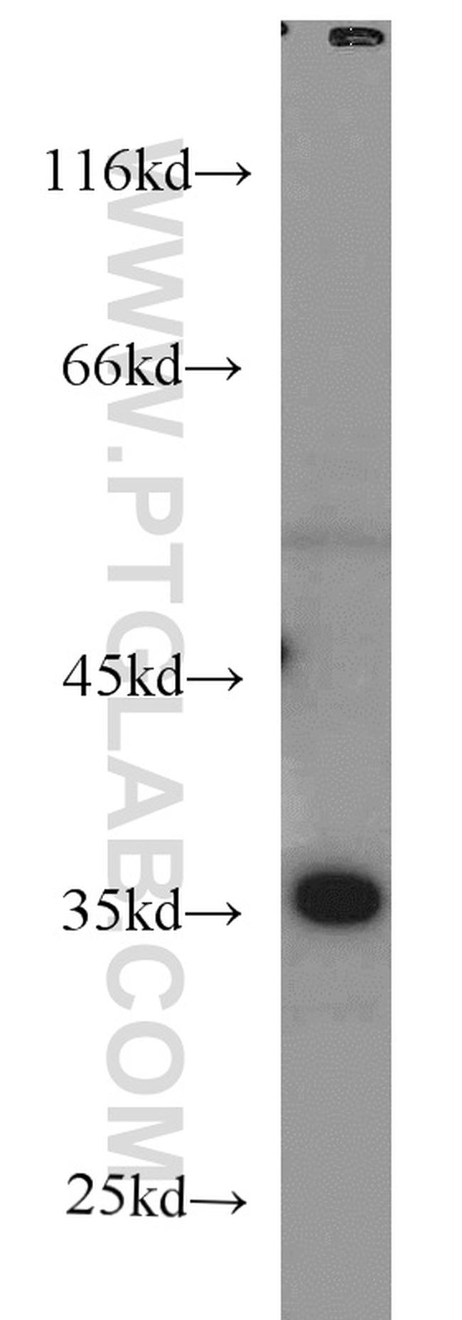 MCL1 Antibody in Western Blot (WB)