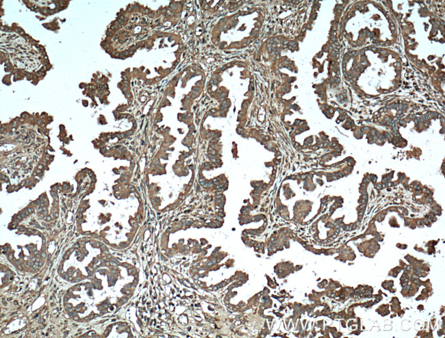 Protein C inhibitor Antibody in Immunohistochemistry (Paraffin) (IHC (P))