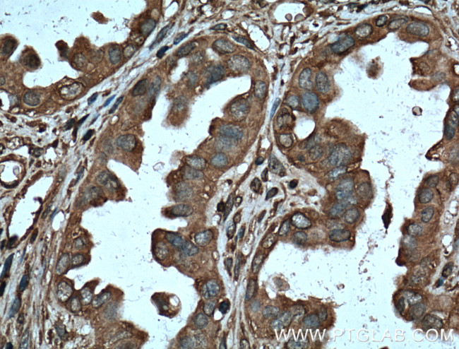 Protein C inhibitor Antibody in Immunohistochemistry (Paraffin) (IHC (P))