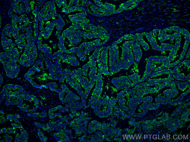 Protein C inhibitor Antibody in Immunohistochemistry (PFA fixed) (IHC (PFA))