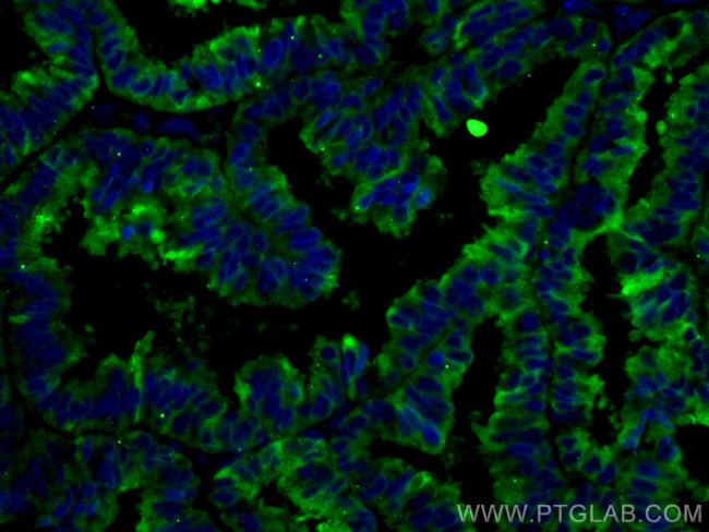 Protein C inhibitor Antibody in Immunohistochemistry (PFA fixed) (IHC (PFA))