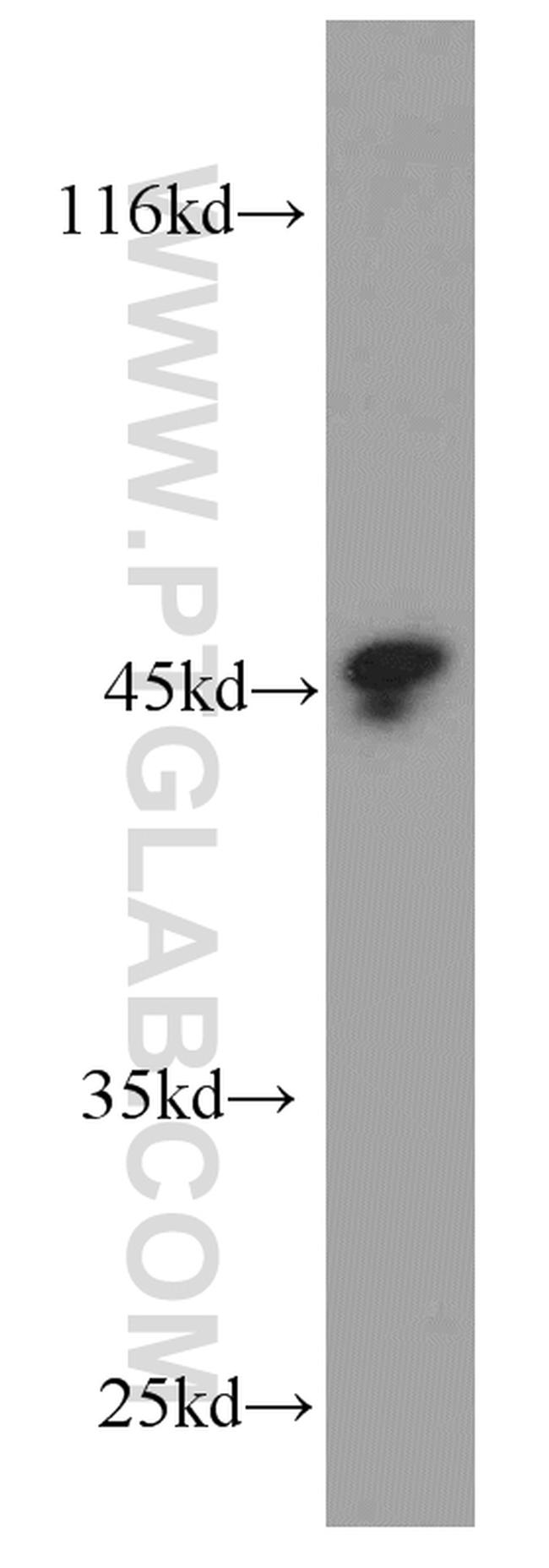 Protein C inhibitor Antibody in Western Blot (WB)