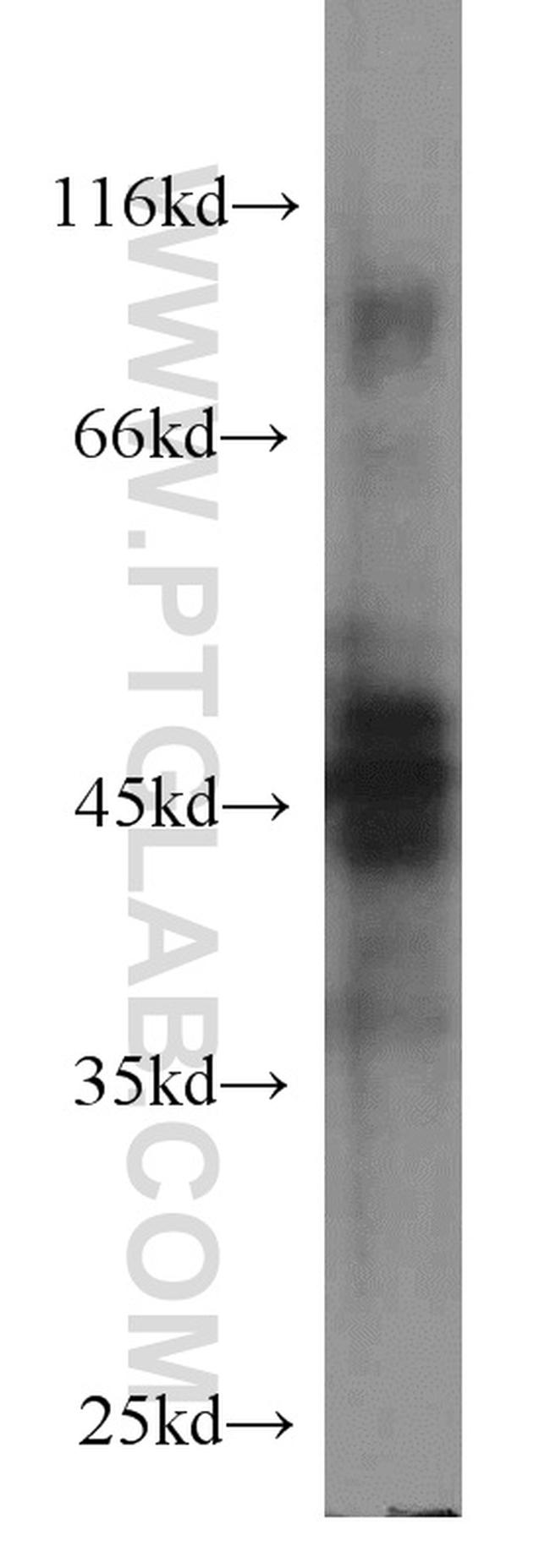 Protein C inhibitor Antibody in Western Blot (WB)