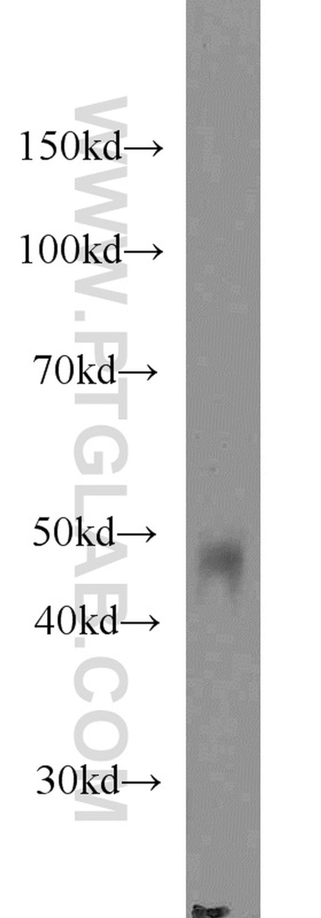 Protein C inhibitor Antibody in Western Blot (WB)