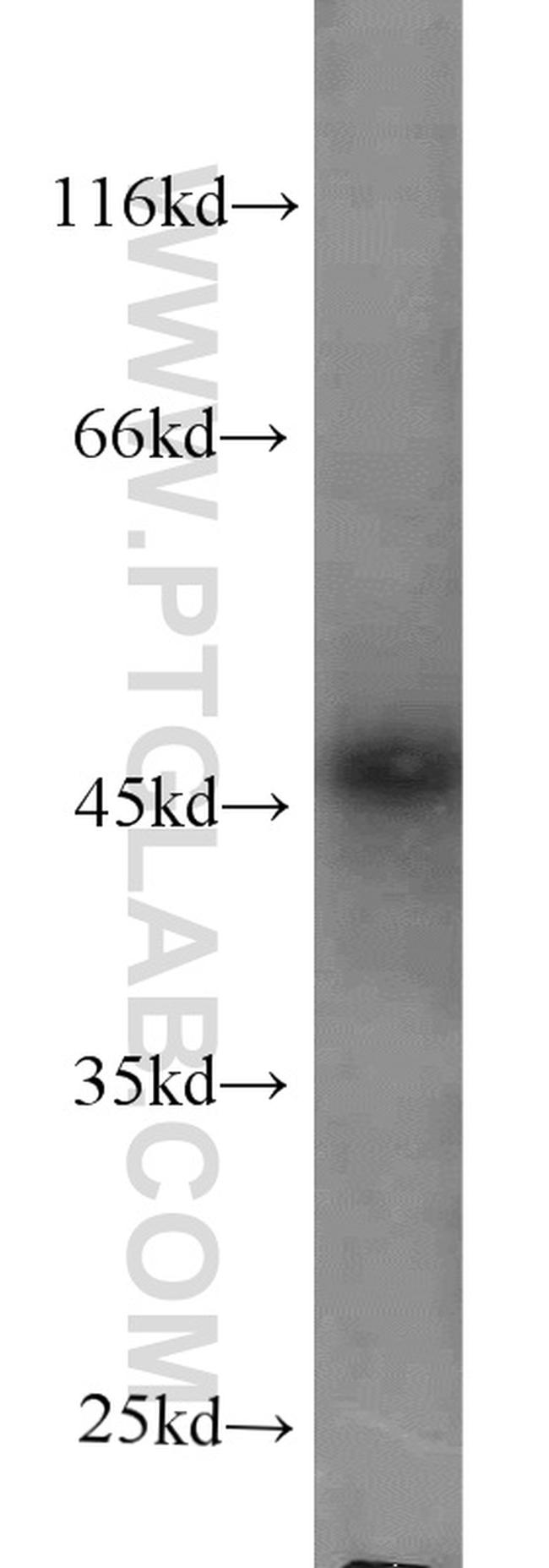 Protein C inhibitor Antibody in Western Blot (WB)