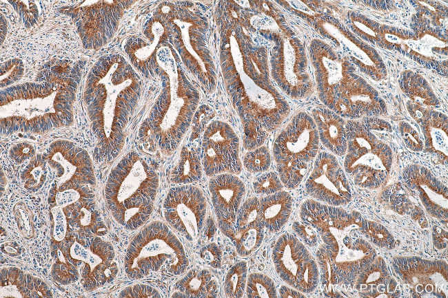 alpha Tubulin Antibody in Immunohistochemistry (Paraffin) (IHC (P))