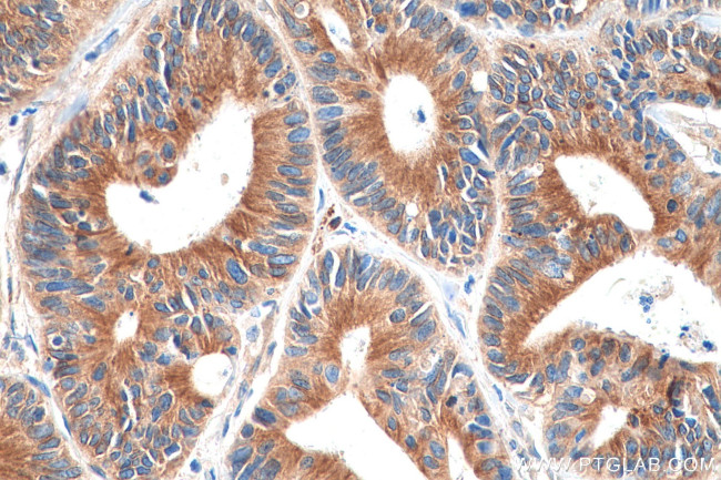 alpha Tubulin Antibody in Immunohistochemistry (Paraffin) (IHC (P))