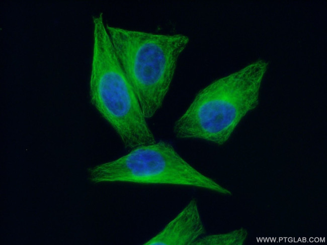 alpha Tubulin Antibody in Immunocytochemistry (ICC/IF)