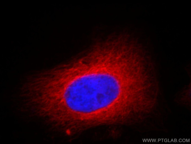 alpha Tubulin Antibody in Immunocytochemistry (ICC/IF)