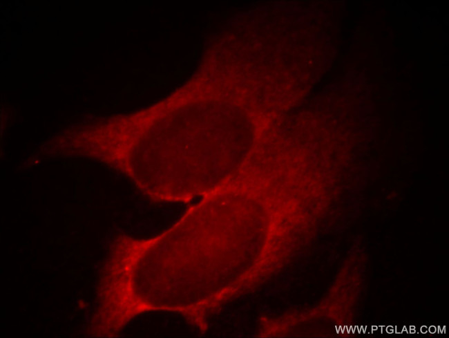 IVD Antibody in Immunocytochemistry (ICC/IF)