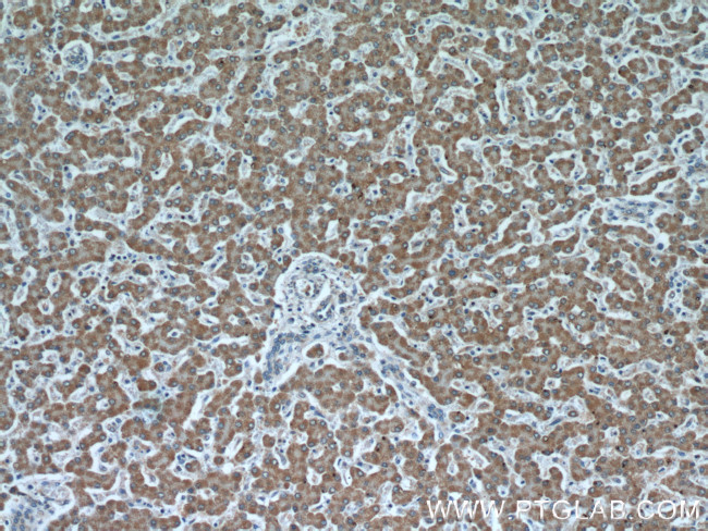 IVD Antibody in Immunohistochemistry (Paraffin) (IHC (P))