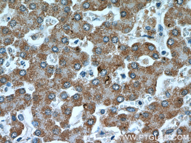 IVD Antibody in Immunohistochemistry (Paraffin) (IHC (P))