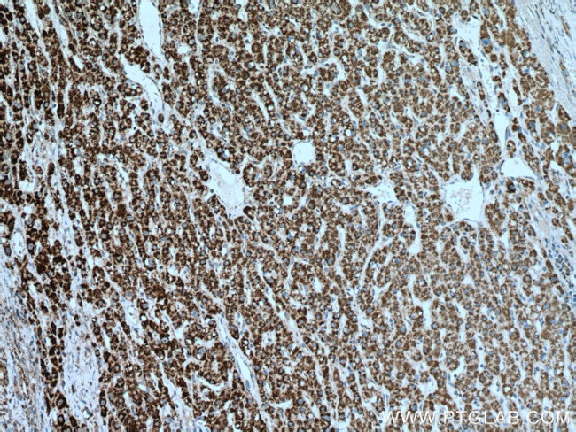 IVD Antibody in Immunohistochemistry (Paraffin) (IHC (P))