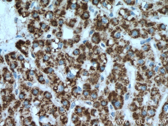 IVD Antibody in Immunohistochemistry (Paraffin) (IHC (P))