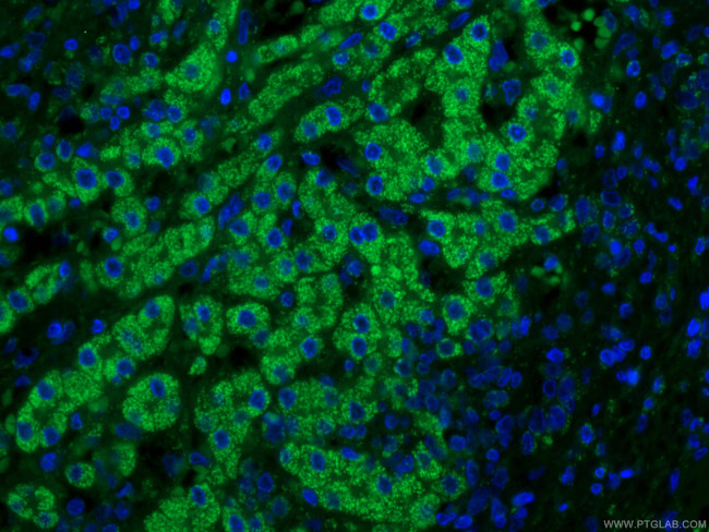 IVD Antibody in Immunohistochemistry (PFA fixed) (IHC (PFA))