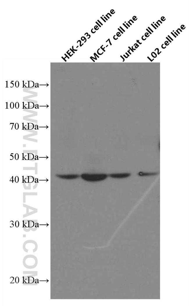 IVD Antibody in Western Blot (WB)