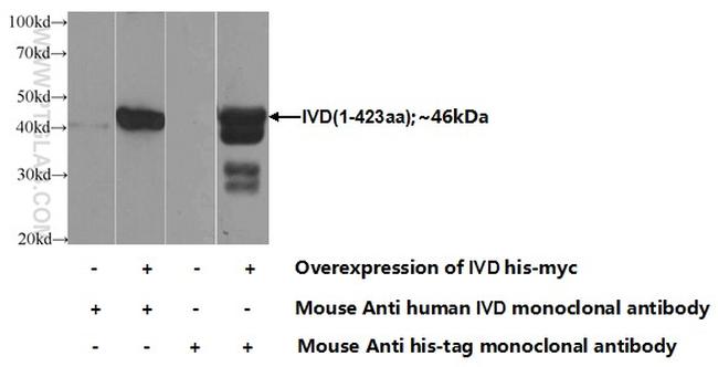 IVD Antibody in Western Blot (WB)