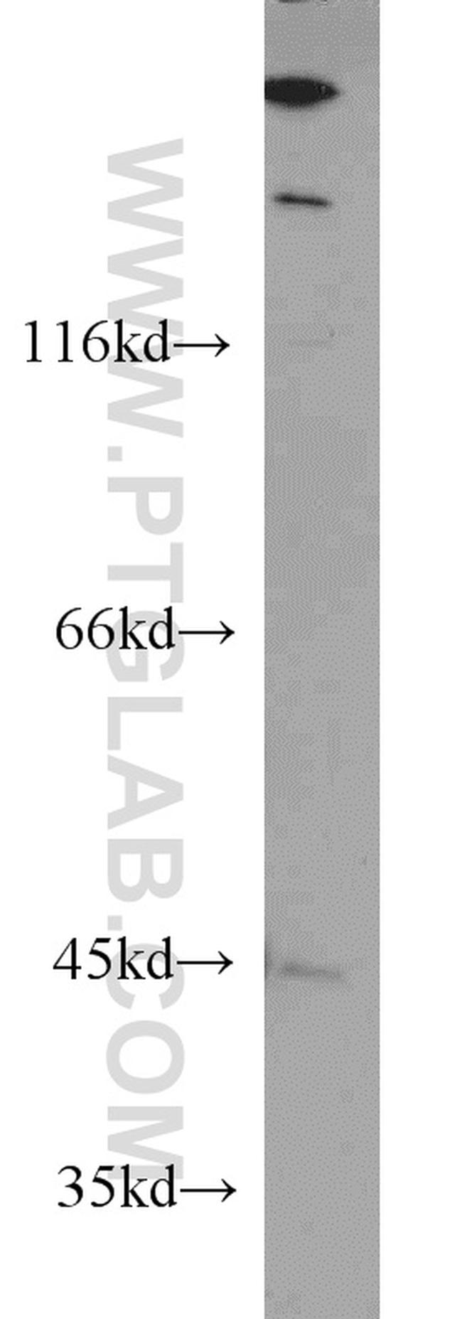 IVD Antibody in Western Blot (WB)