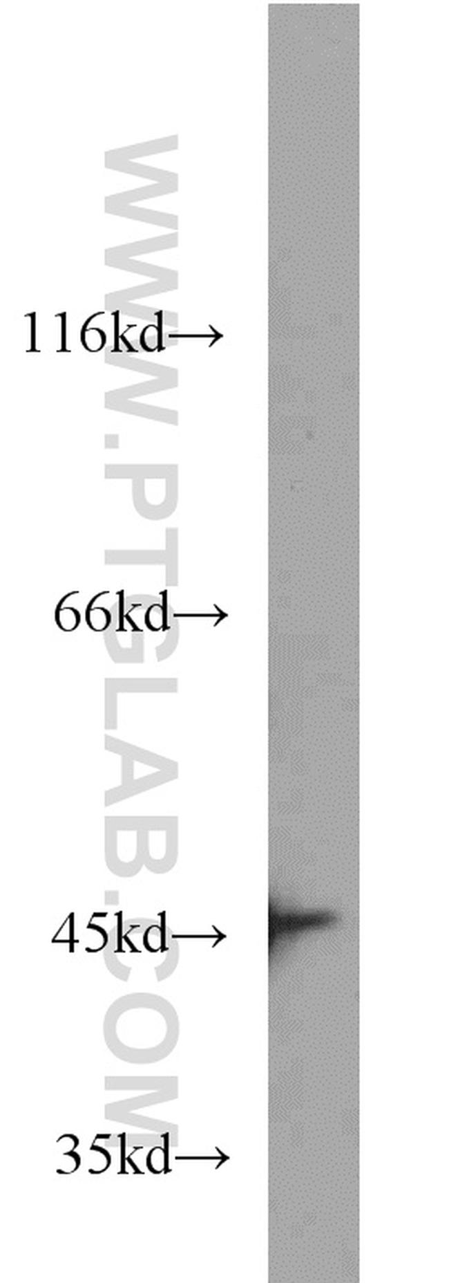 IVD Antibody in Western Blot (WB)