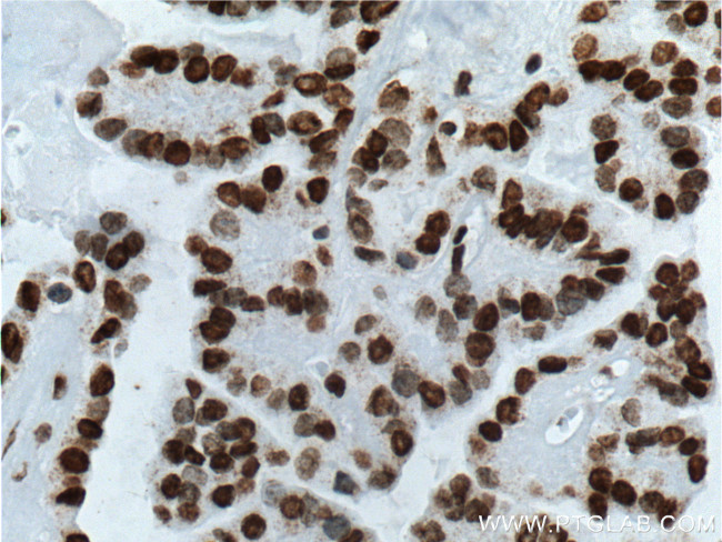 TTF-1 Antibody in Immunohistochemistry (Paraffin) (IHC (P))